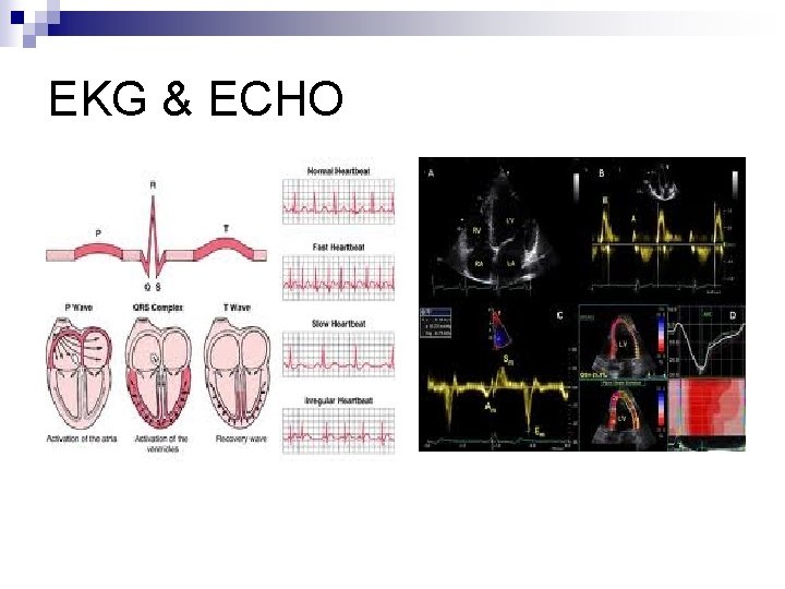 EKG & ECHO 