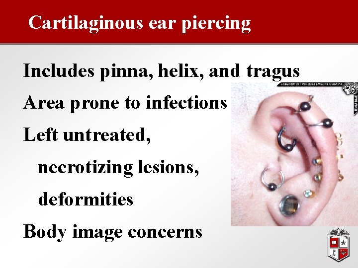 Cartilaginous ear piercing Includes pinna, helix, and tragus Area prone to infections Left untreated,