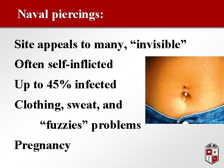 Naval piercings: Site appeals to many, “invisible” Often self-inflicted Up to 45% infected Clothing,