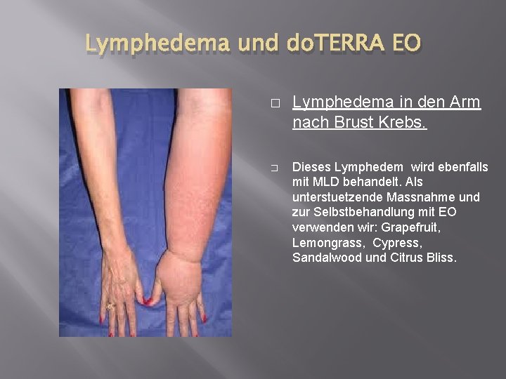 Lymphedema und do. TERRA EO � � Lymphedema in den Arm nach Brust Krebs.