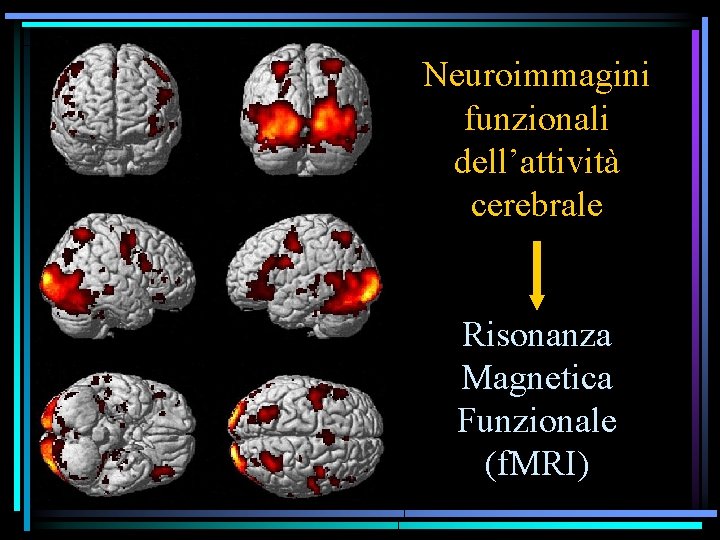 Neuroimmagini funzionali dell’attività cerebrale Risonanza Magnetica Funzionale (f. MRI) 