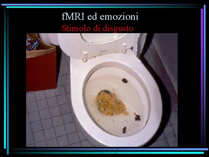 f. MRI ed emozioni Stimolo di disgusto 