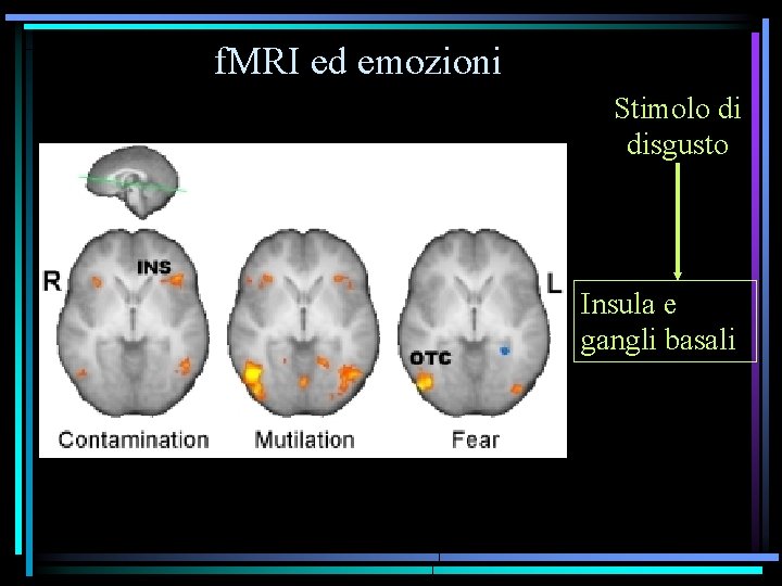 f. MRI ed emozioni Stimolo di disgusto Insula e gangli basali 