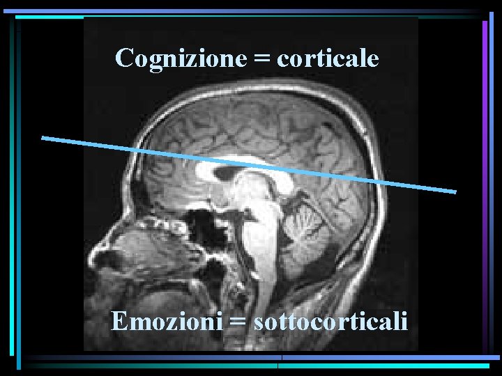 Cognizione = corticale Emozioni = sottocorticali 