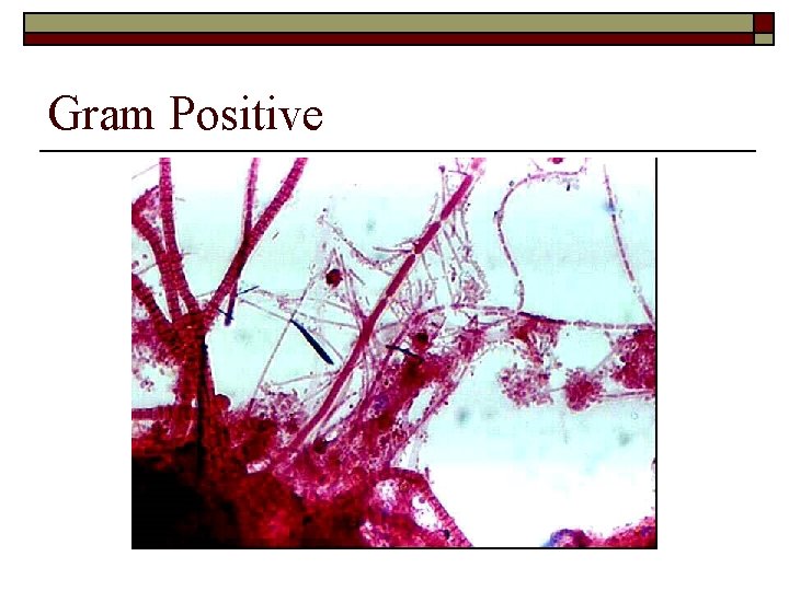Gram Positive 