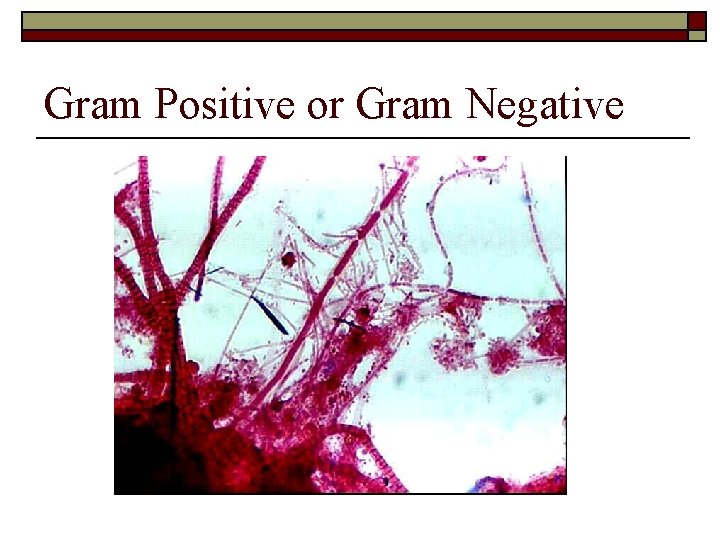 Gram Positive or Gram Negative 