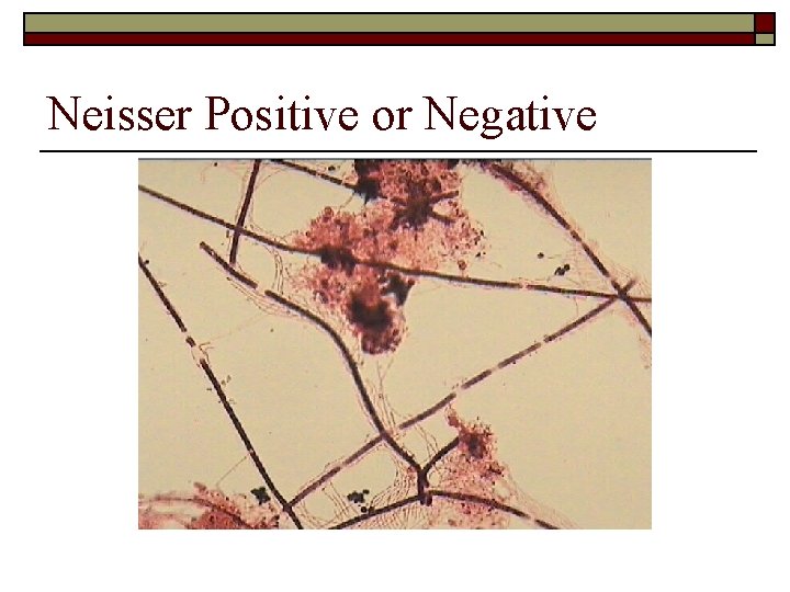 Neisser Positive or Negative 