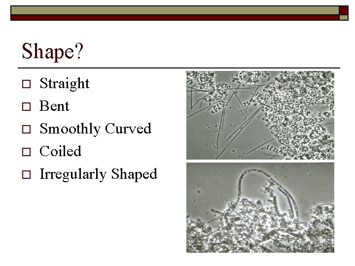 Shape? o o o Straight Bent Smoothly Curved Coiled Irregularly Shaped 