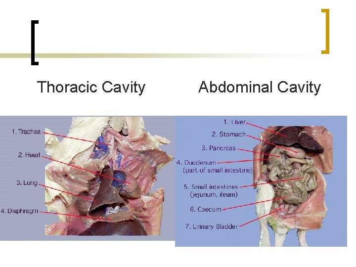 Thoracic Cavity Abdominal Cavity 