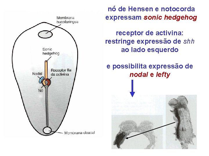 nó de Hensen e notocorda Genes que regulam a assimetria direita-esquerda expressam sonic hedgehog