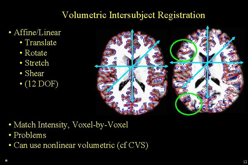 Volumetric Intersubject Registration • Affine/Linear • Translate • Rotate • Stretch • Shear •