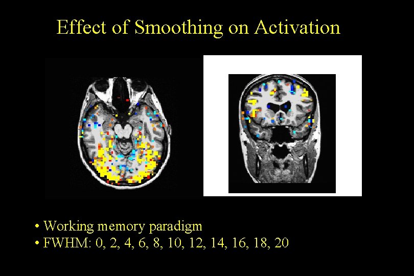 Effect of Smoothing on Activation • Working memory paradigm • FWHM: 0, 2, 4,