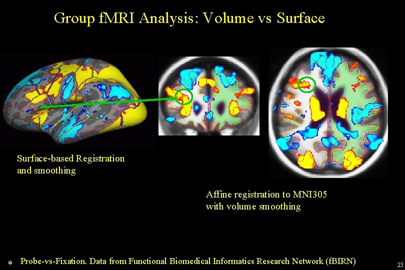 Group f. MRI Analysis: Volume vs Surface-based Registration and smoothing Affine registration to MNI