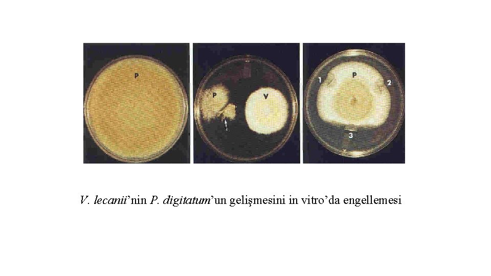 V. lecanii’nin P. digitatum’un gelişmesini in vitro’da engellemesi 