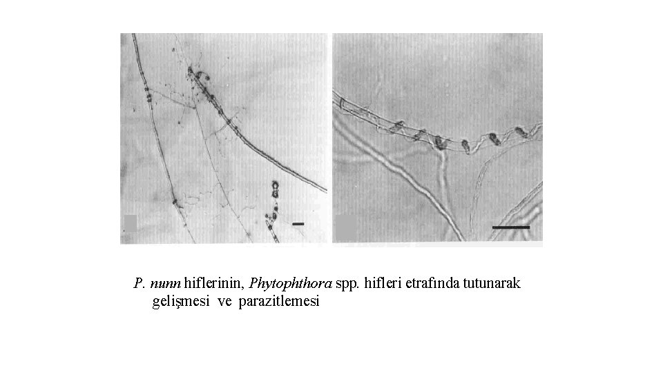 P. nunn hiflerinin, Phytophthora spp. hifleri etrafında tutunarak gelişmesi ve parazitlemesi 