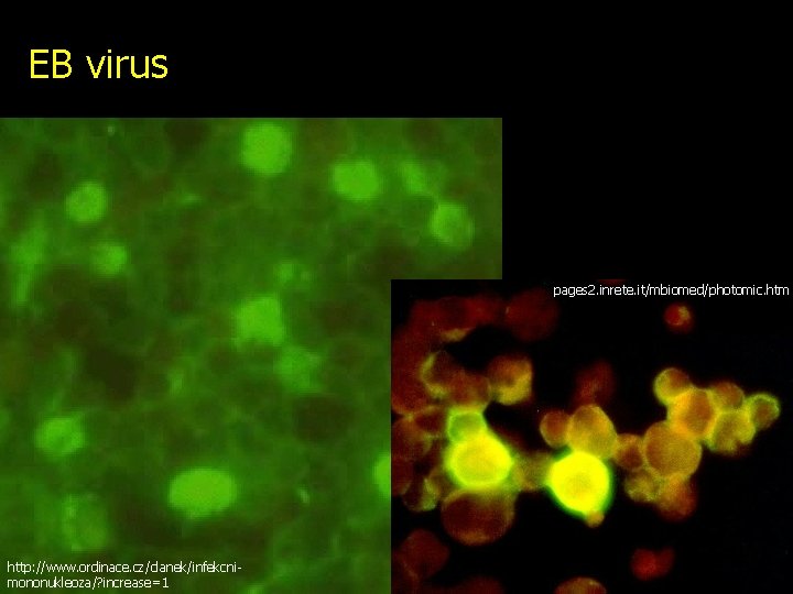 EB virus pages 2. inrete. it/mbiomed/photomic. htm http: //www. ordinace. cz/clanek/infekcnimononukleoza/? increase=1 