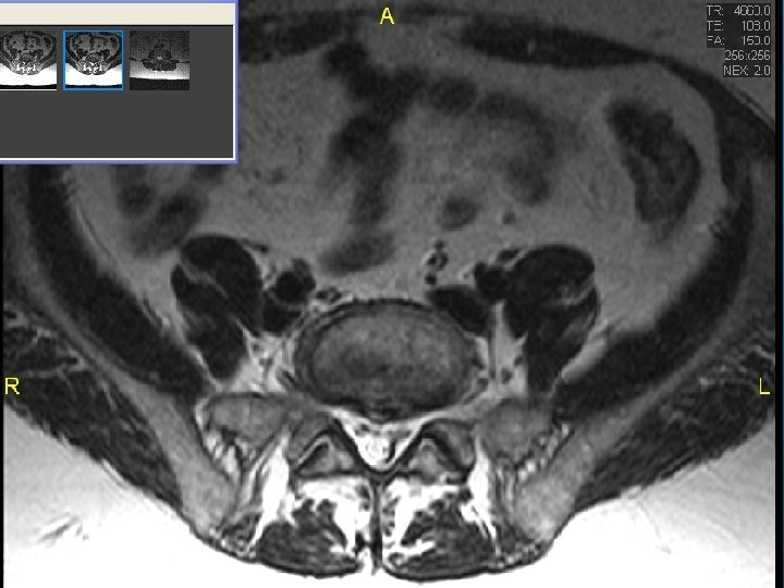 MRI scan slide #4 