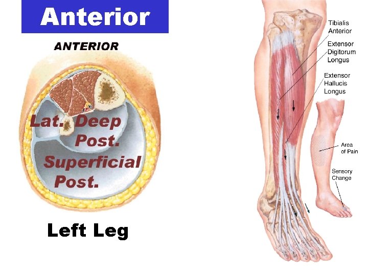 Anterior Left Leg 