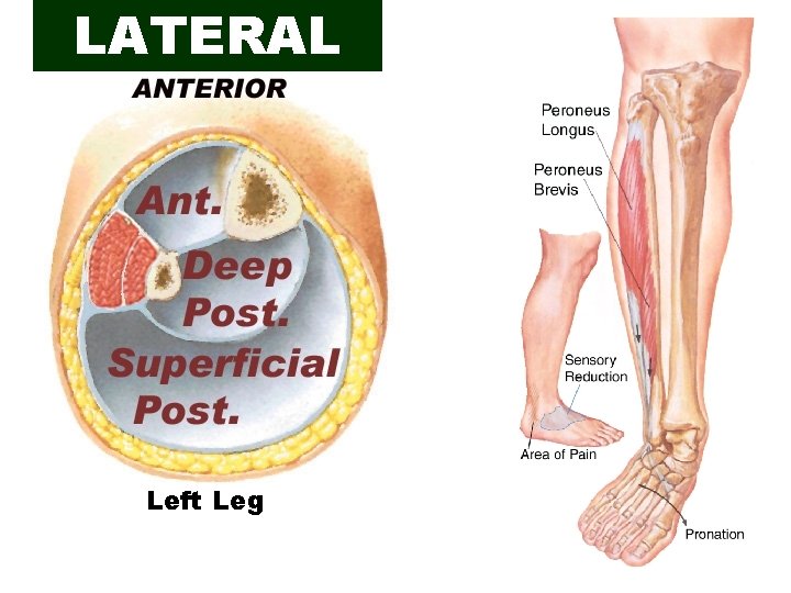 LATERAL Left Leg 