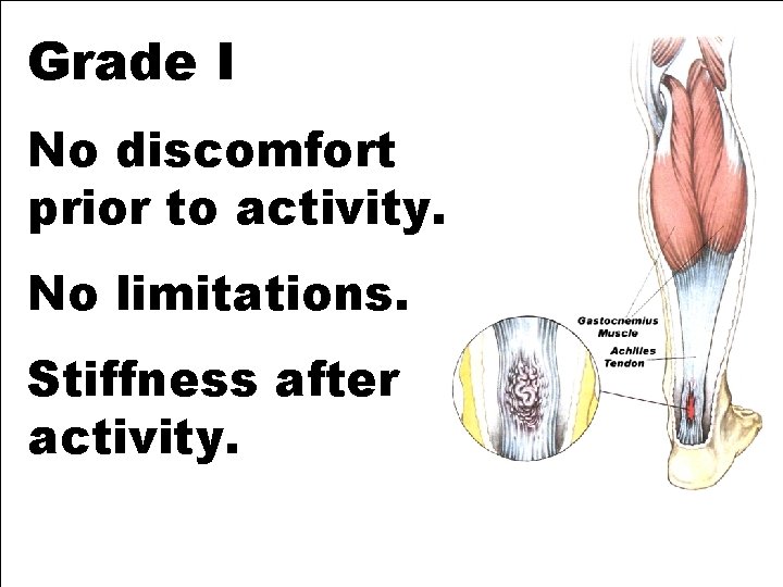 Grade I No discomfort prior to activity. No limitations. Stiffness after activity. 