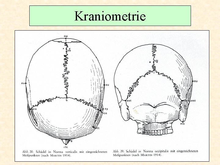 Kraniometrie 
