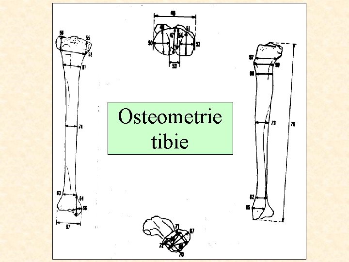 Osteometrie tibie 
