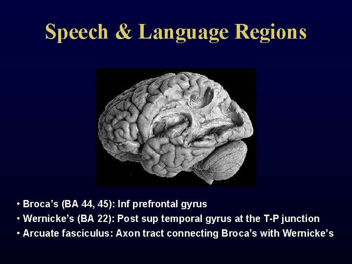 Speech & Language Regions • Broca’s (BA 44, 45): Inf prefrontal gyrus • Wernicke’s