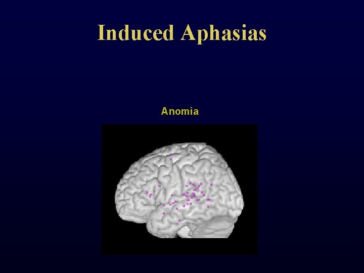 Induced Aphasias Anomia 