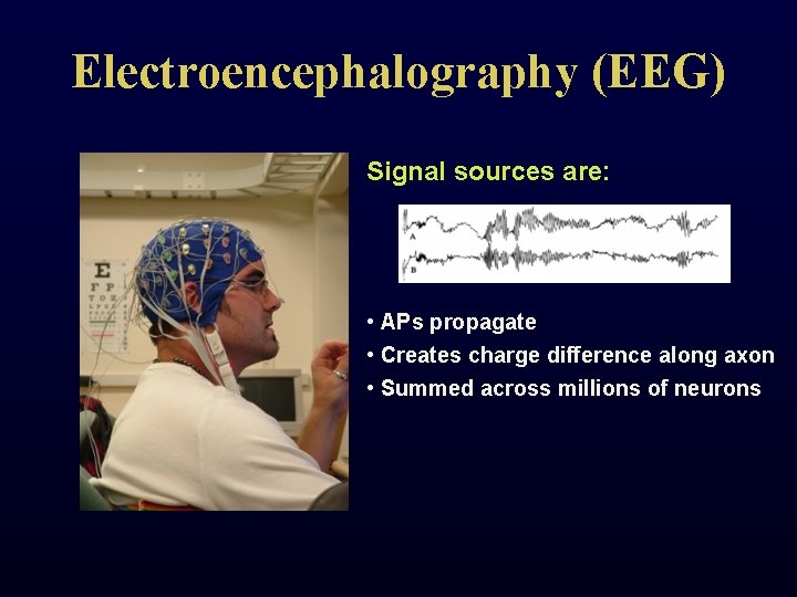 Electroencephalography (EEG) Signal sources are: • APs propagate • Creates charge difference along axon