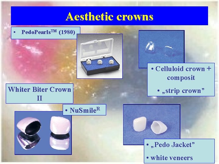 Aesthetic crowns • Pedo. Pearls. TM (1980) • Celluloid crown + composit Whiter Biter