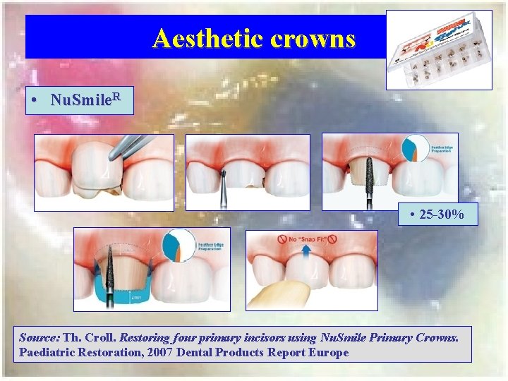 Aesthetic crowns • Nu. Smile. R • 25 -30% Source: Th. Croll. Restoring four