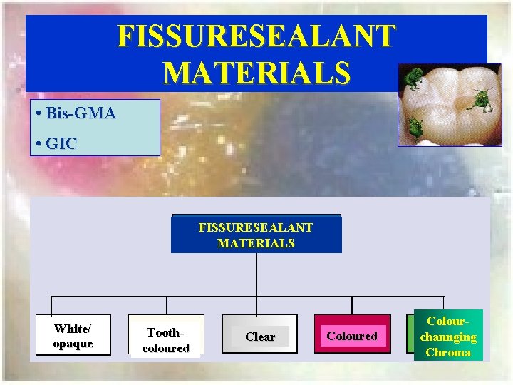 FISSURESEALANT MATERIALS • Bis-GMA • GIC FISSURESEALANT MATERIALS White/ opaque Toothcoloured Clear Coloured Colourchannging