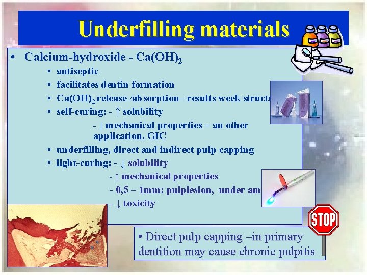 Underfilling materials • Calcium-hydroxide - Ca(OH)2 • • antiseptic facilitates dentin formation Ca(OH)2 release