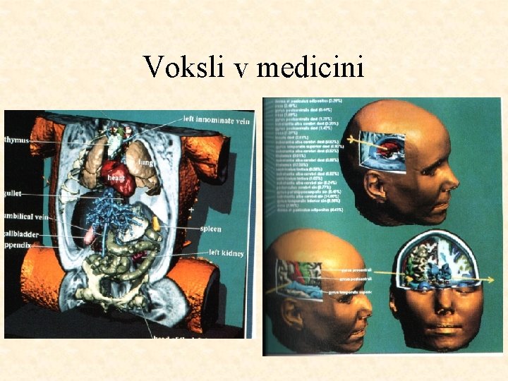 Voksli v medicini 