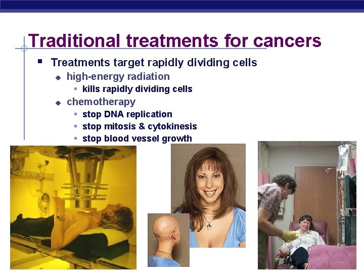 Traditional treatments for cancers § Treatments target rapidly dividing cells u high-energy radiation §
