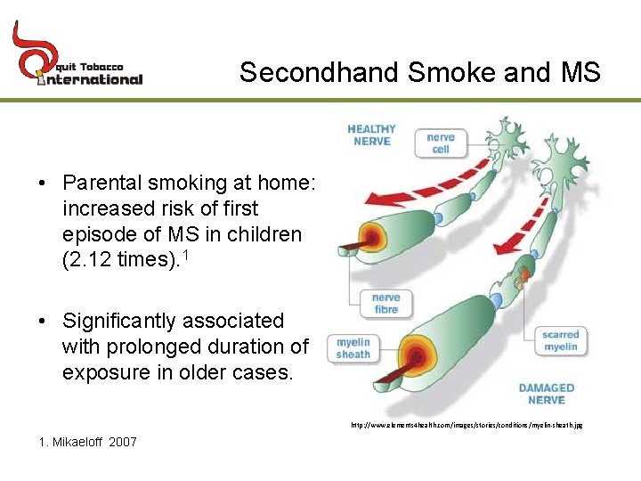 Secondhand Smoke and MS • Parental smoking at home: increased risk of first episode