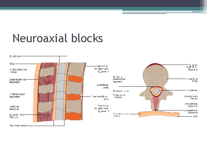 Neuroaxial blocks 