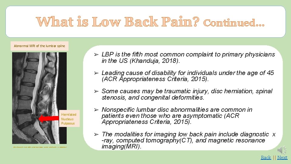 What is Low Back Pain? Continued… Abnormal MRI of the lumbar spine ➢ LBP