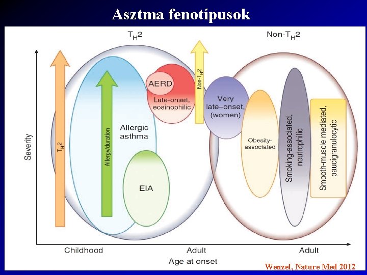 Asztma fenotípusok Wenzel, Nature Med 2012 