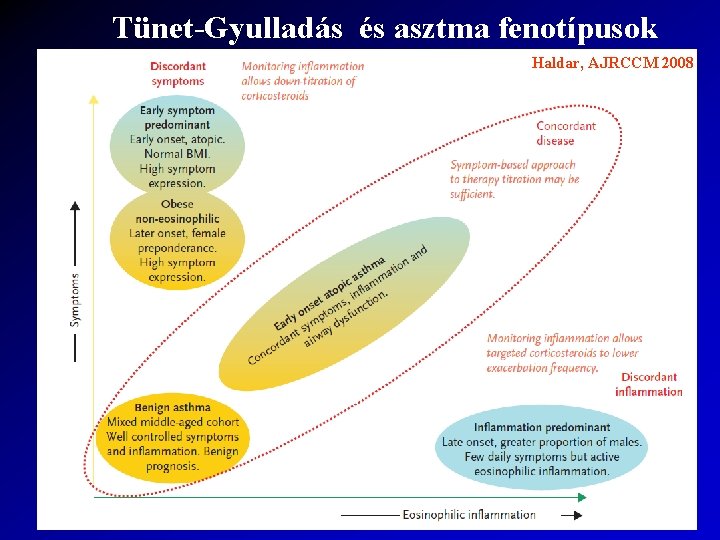 Tünet-Gyulladás és asztma fenotípusok Haldar, AJRCCM 2008 