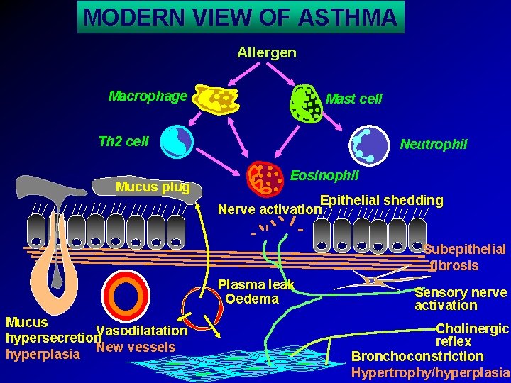 MODERN VIEW OF ASTHMA Allergen Macrophage Mast cell Th 2 cell Mucus plug Neutrophil