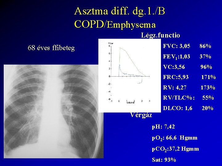 Asztma diff. dg. 1. /B COPD/Emphysema Légz. functio 68 éves ffibeteg Vérgáz FVC: 3,