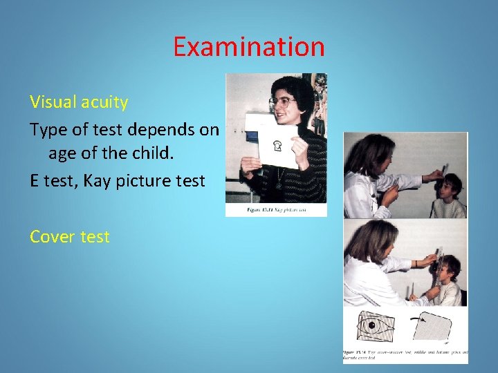 Examination Visual acuity Type of test depends on age of the child. E test,