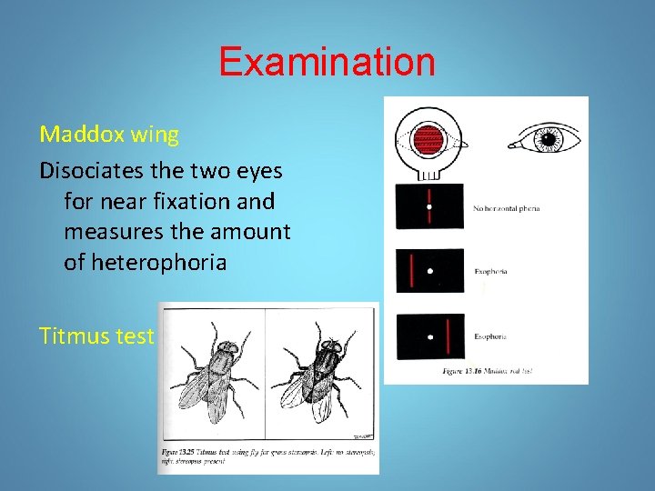 Examination Maddox wing Disociates the two eyes for near fixation and measures the amount