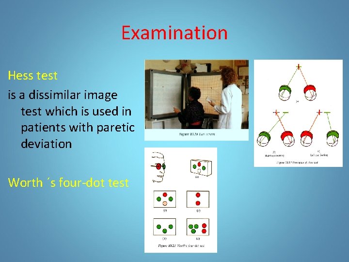 Examination Hess test is a dissimilar image test which is used in patients with