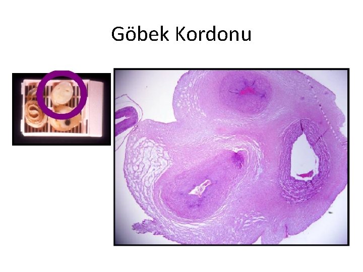 Göbek Kordonu 