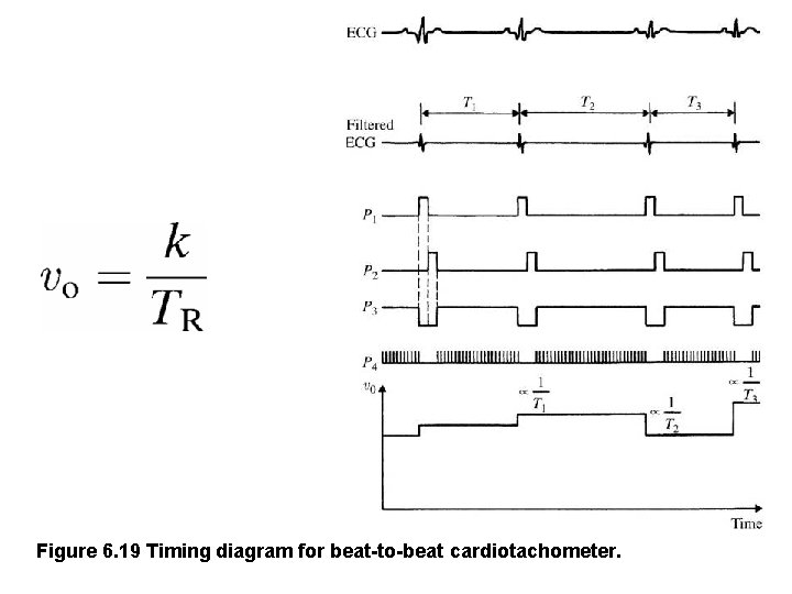 Figure 6. 19 Timing diagram for beat-to-beat cardiotachometer. 