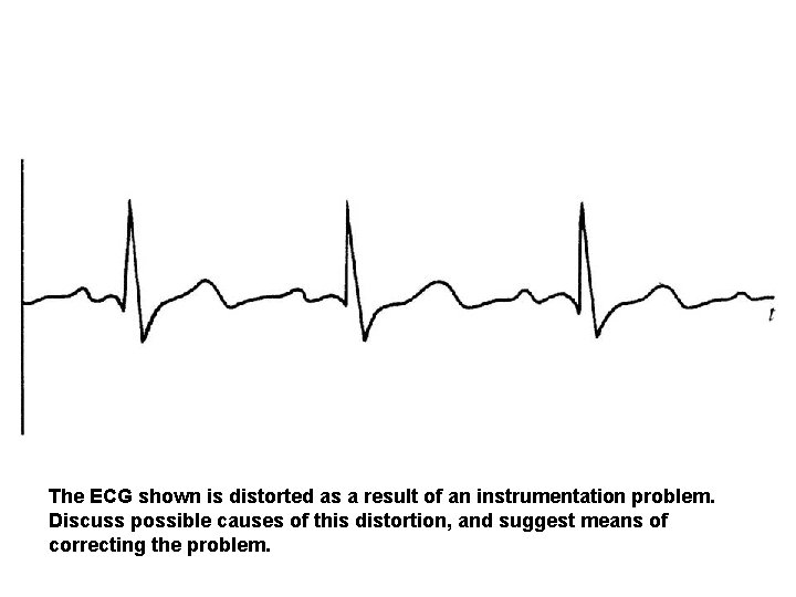 The ECG shown is distorted as a result of an instrumentation problem. Discuss possible