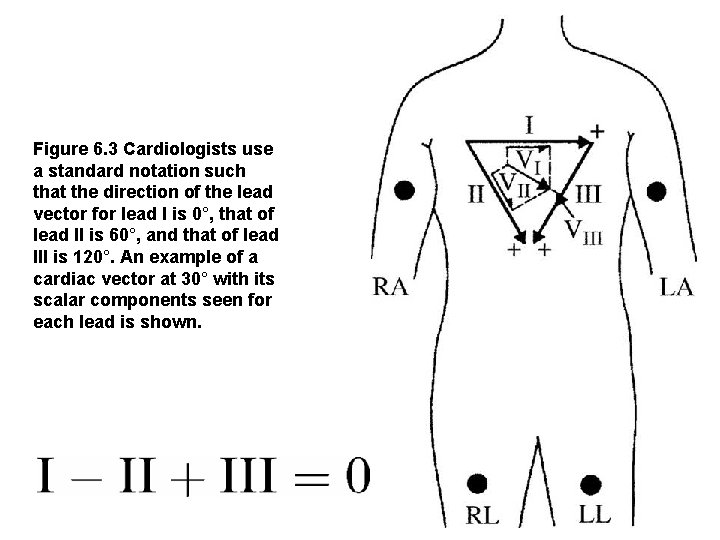 Figure 6. 3 Cardiologists use a standard notation such that the direction of the