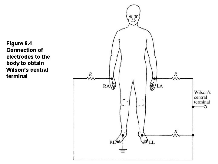 Figure 6. 4 Connection of electrodes to the body to obtain Wilson’s central terminal